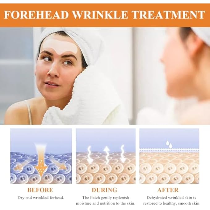 EELHOE PACK OF 30 FOREHEAD MICRONEEDLING FACIAL PATCHES, WRINKLE PLASTERS, KEEPS SKIN MOIST AND SOFT AND FILLS SKIN MOISTURE, SMOOTHS FINE LINES AND WRINKLES - Image 3